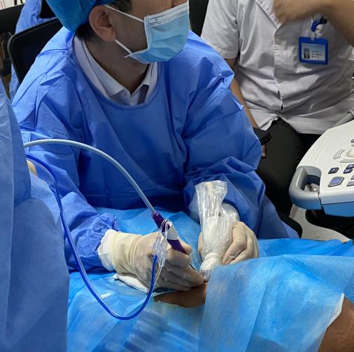 甲状腺结节微波消融术,厦门有微波消融术治疗甲状腺结节