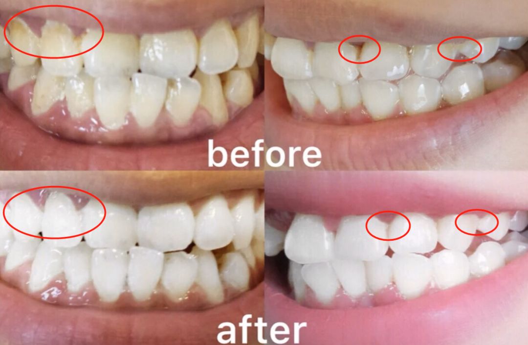 口腔专用香水,能持久留香的口腔香水