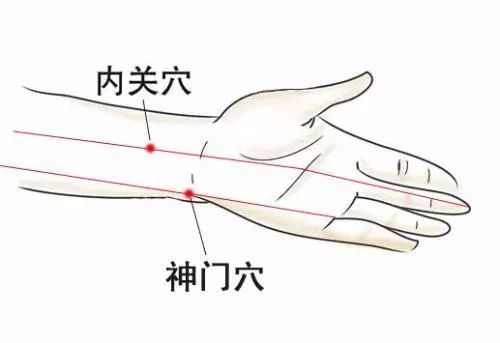 针灸治疗失眠患者一例,针灸调理失眠的病例