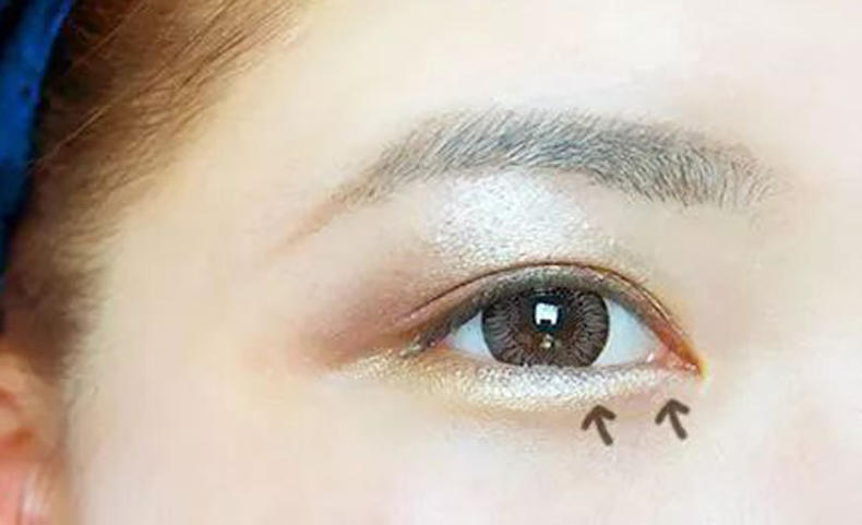 脸部越来越凹陷怎么改善,面部凹陷干瘪怎么快变饱满