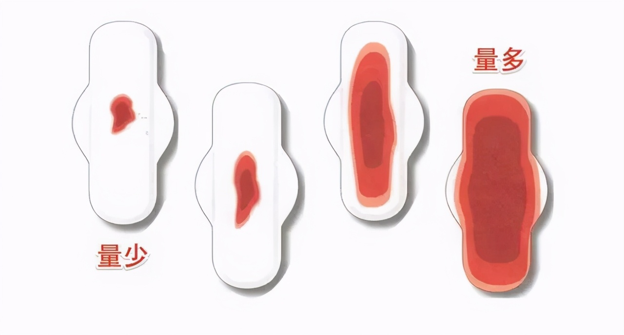 月经量少针灸,医生讲解月经量少