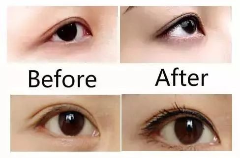 关于美瞳,美瞳线常见问题解析