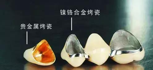 烤瓷牙瓷掉了光剩金属了有毒吗,烤瓷牙里面的金属有毒吗