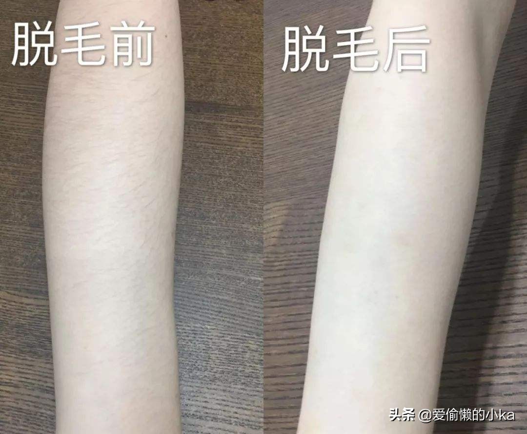 露腿最佳的季节,露腿季节来了