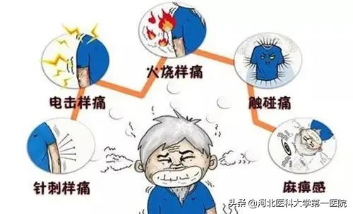 缠腰龙皮肤科,一种叫缠腰蛇的皮肤病是什么