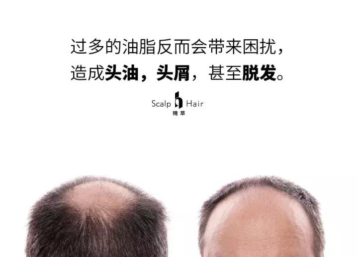 防脱的几种情况,防脱问题图