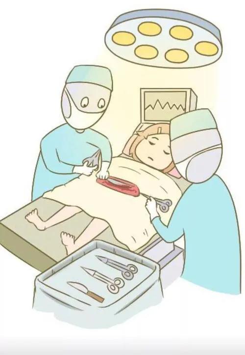 第25课主要内容,孕多少周最适合剖宫产