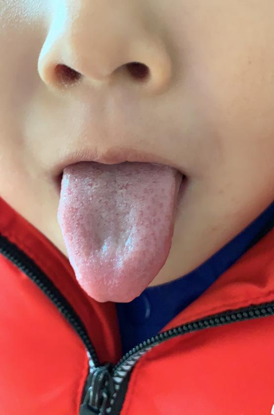 熬夜后盗汗鼻出血,一个月之内盗汗好几次是怎么回事