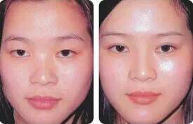 高颧骨为什么是高级脸,颧骨高的普通人