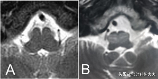 放射科趣味图片,放射科亮点图片