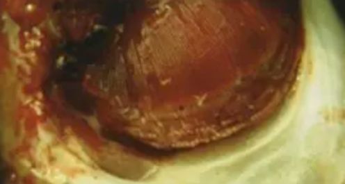 水产镜检虫图片,水产养殖常见虫类图