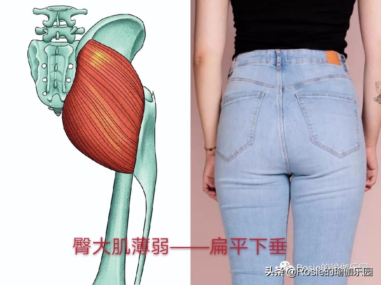 真翘臀和假翘臀怎么辨别,怎样判断翘臀是不是假的