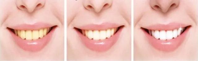 刷牙的正确方法牙不黄不臭,刷牙牙黄变白的最快方法