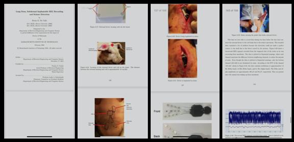 马斯克演示脑机接口植入猪脑,马斯克与比尔盖茨对人类的贡献