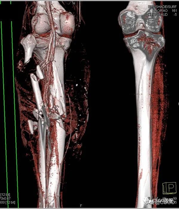 csgo和别的枪战游戏区别,csgo与现实