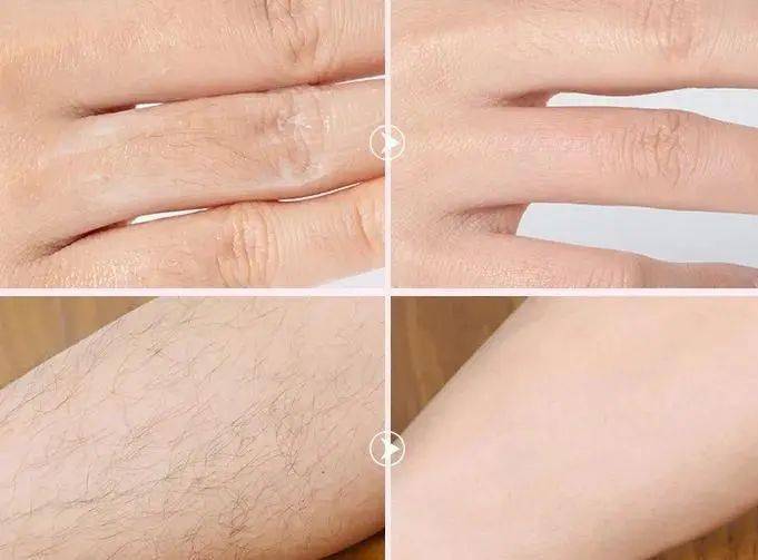 屈臣氏脱毛膏修复女士专用,屈臣氏脱毛膏新款