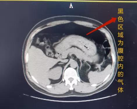 用气枪误伤同事,用气枪打猎物同伙会被判多少年