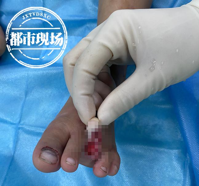 男孩脚被石头压伤,南昌三岁男童搬石头砸自己脚