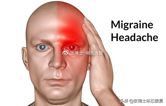 头痛康复锻炼方法,运动导致的头痛怎么缓解