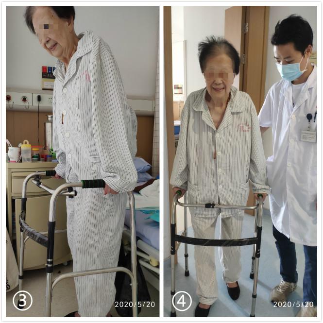 为什么说伤筋动骨一百天,都说伤筋动骨一百天是啥意思