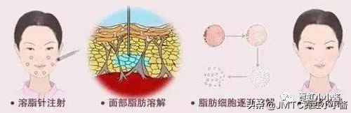 日本小姐姐针灸瘦脸视频,小姐姐打瘦脸针视频