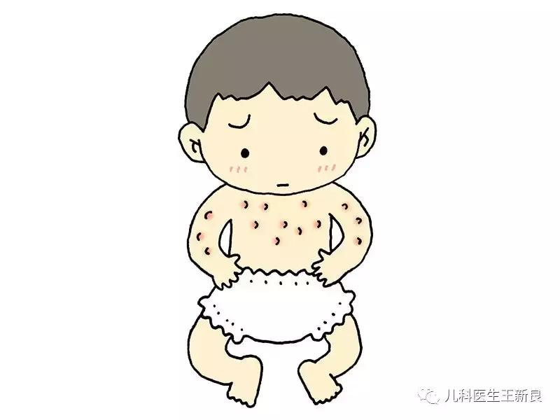 过敏性紫癜和血小板减少性紫癜,过敏性紫癜抽血后腿上紫癜增多