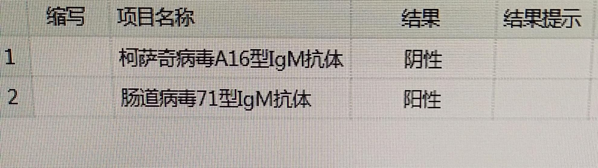 1岁小孩抽搐症主要表现是怎样的,1岁多手足口病吃药可以痊愈吗