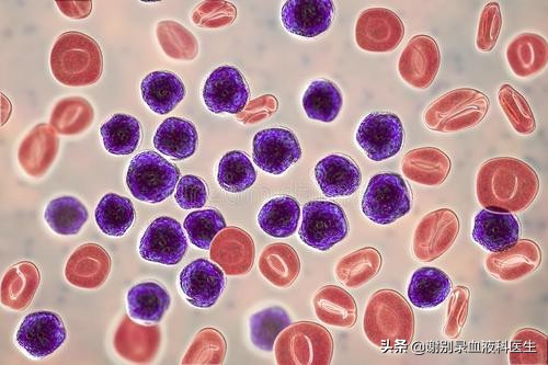 急性髓细胞白血病复发如何治疗？