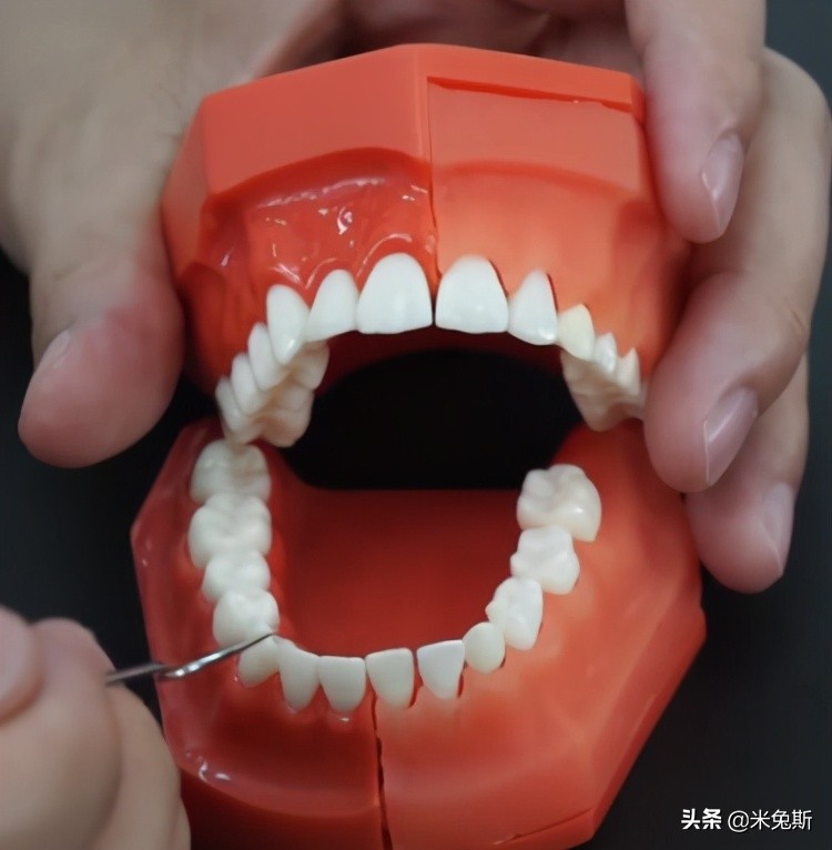 大家牙齿发育的怎么样,大家牙齿都长什么样