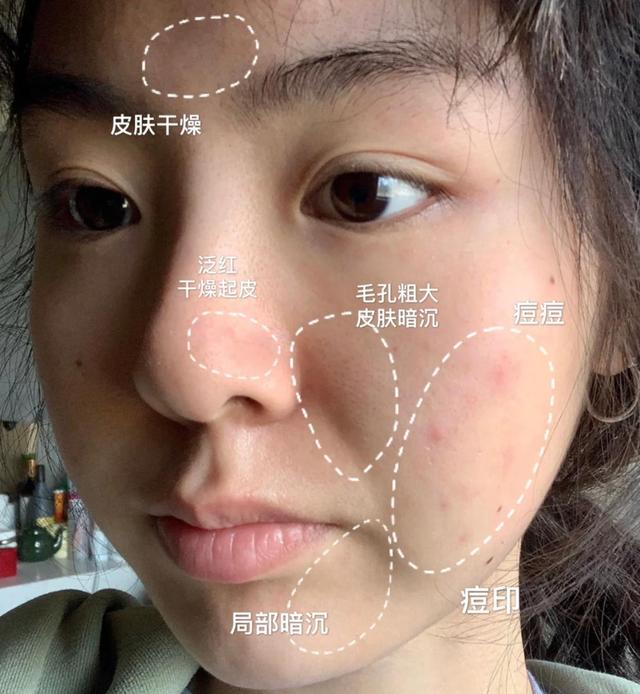 面膜敷多长时间才是正确的,面膜多久敷一次对皮肤好