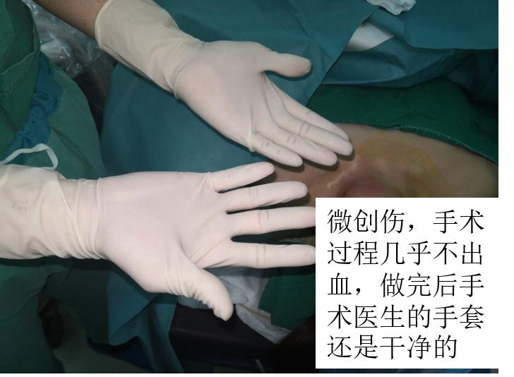 哈尔滨微创消融甲状腺结节哪家好,甲状腺结节微创消融术的过程