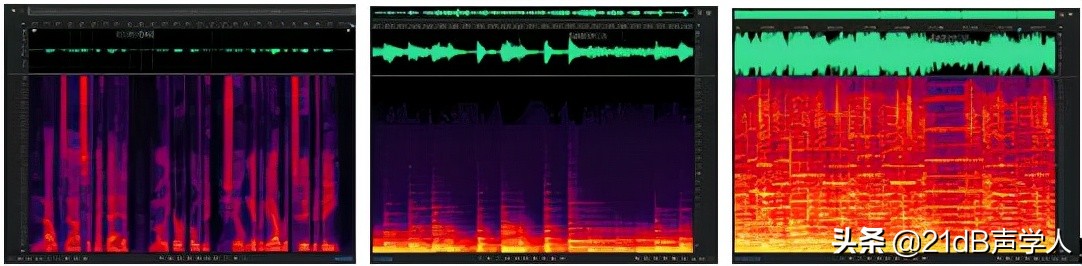 用了人工耳蜗可以听音乐吗,用人工耳蜗可以和正常听力一样吗