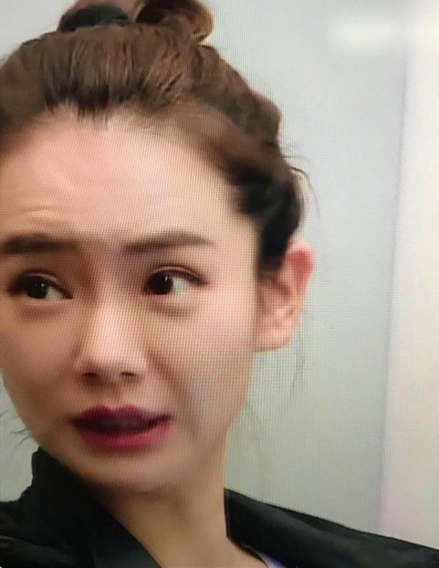 戚薇玻尿酸精华,戚薇玻尿酸