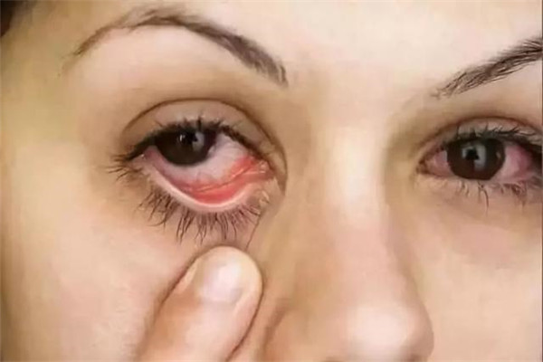 宝宝误拿502胶水滴眼睛怎么办,宝宝误将502滴到眼睛怎么办