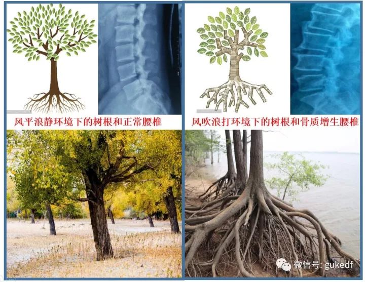 什么叫做骨刺骨刺都长在什么地方,膝盖长骨刺怎么去掉骨刺