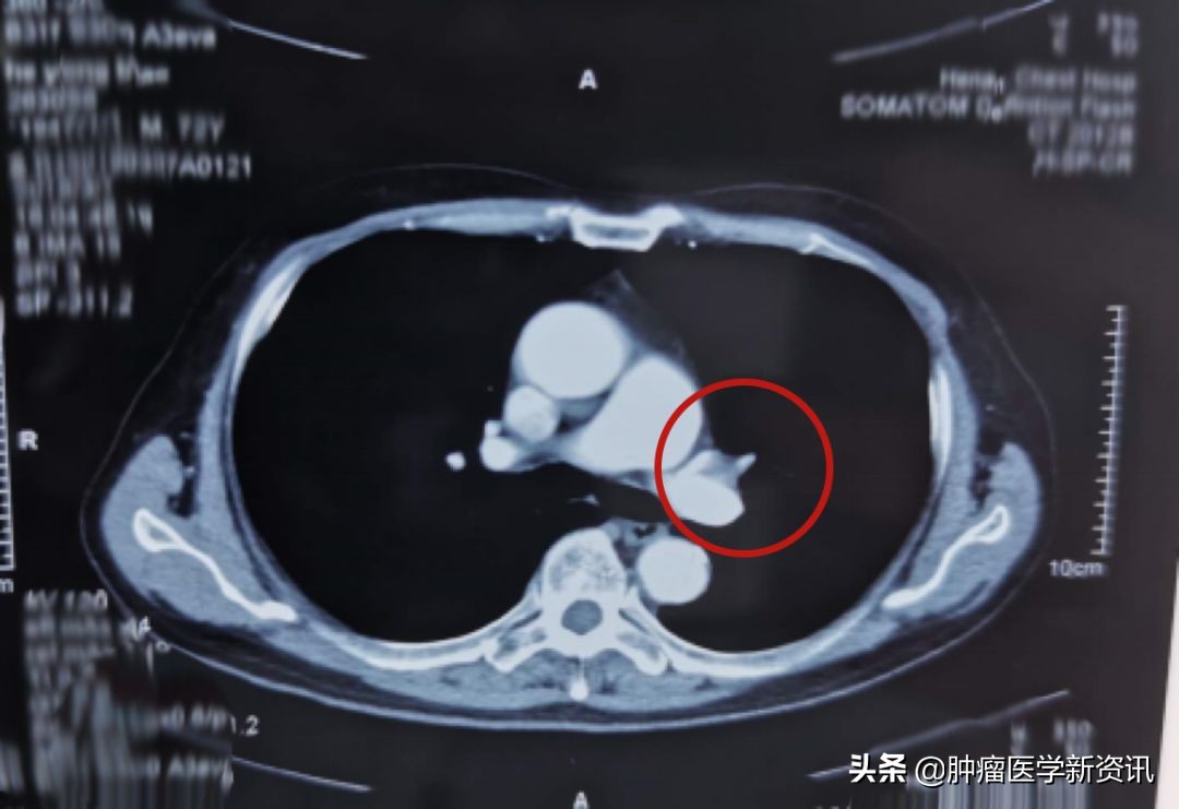 抗癌物质能治愈癌症吗,抗癌成功的几率有多大