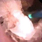 医疗科技最新突破人工肾,医学技术泌尿系统