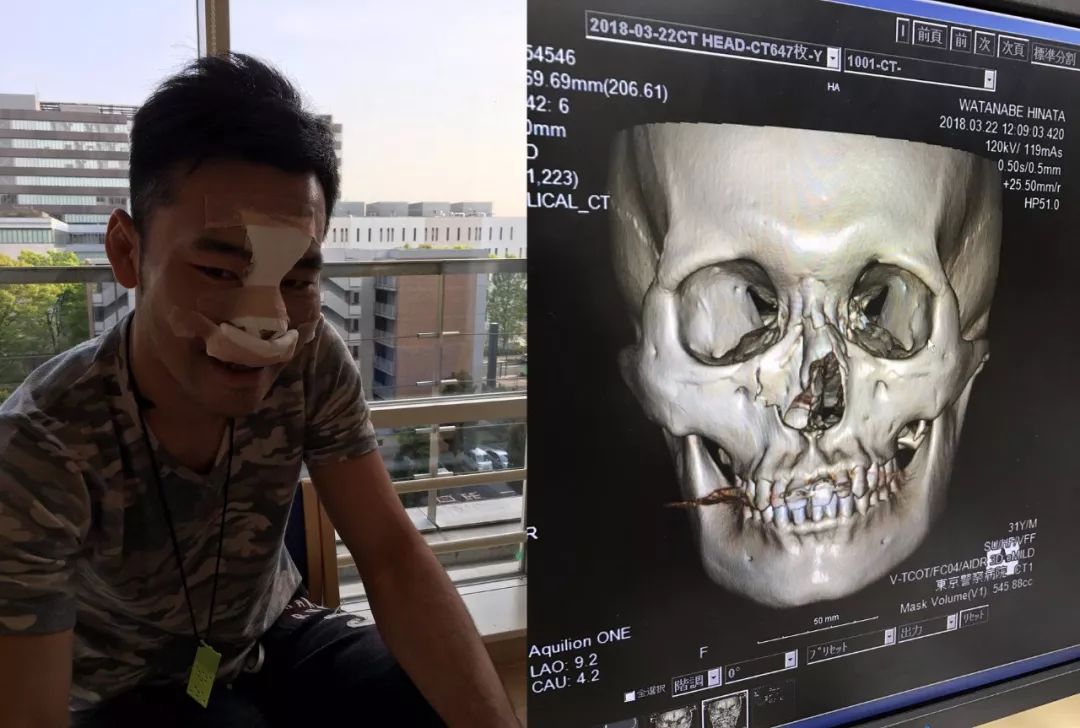 泰拳王江通猜输给俄罗斯牛仔,江通猜vs古拉宾