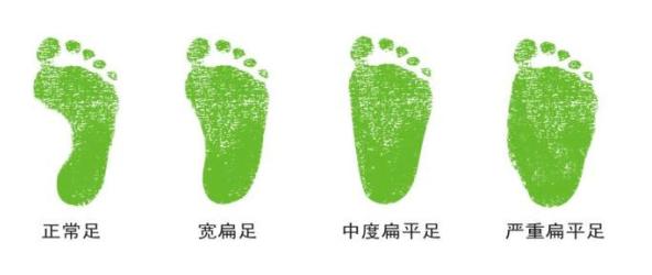 从实验室走出来的“黑科技”——验脚仪