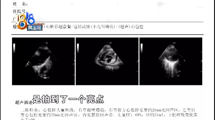 金属丝划破孩子心脏，家长推测“钢丝刷”