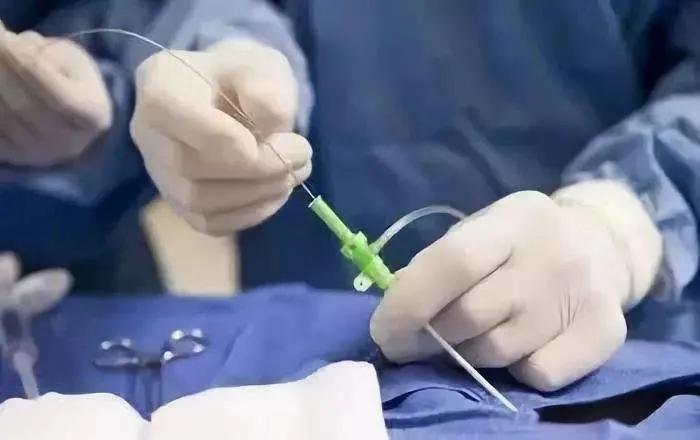 试管初步检查,试管前期检查要看生殖器吗