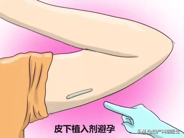 中奖概率问题及解决方法,降低中奖率的最新方法