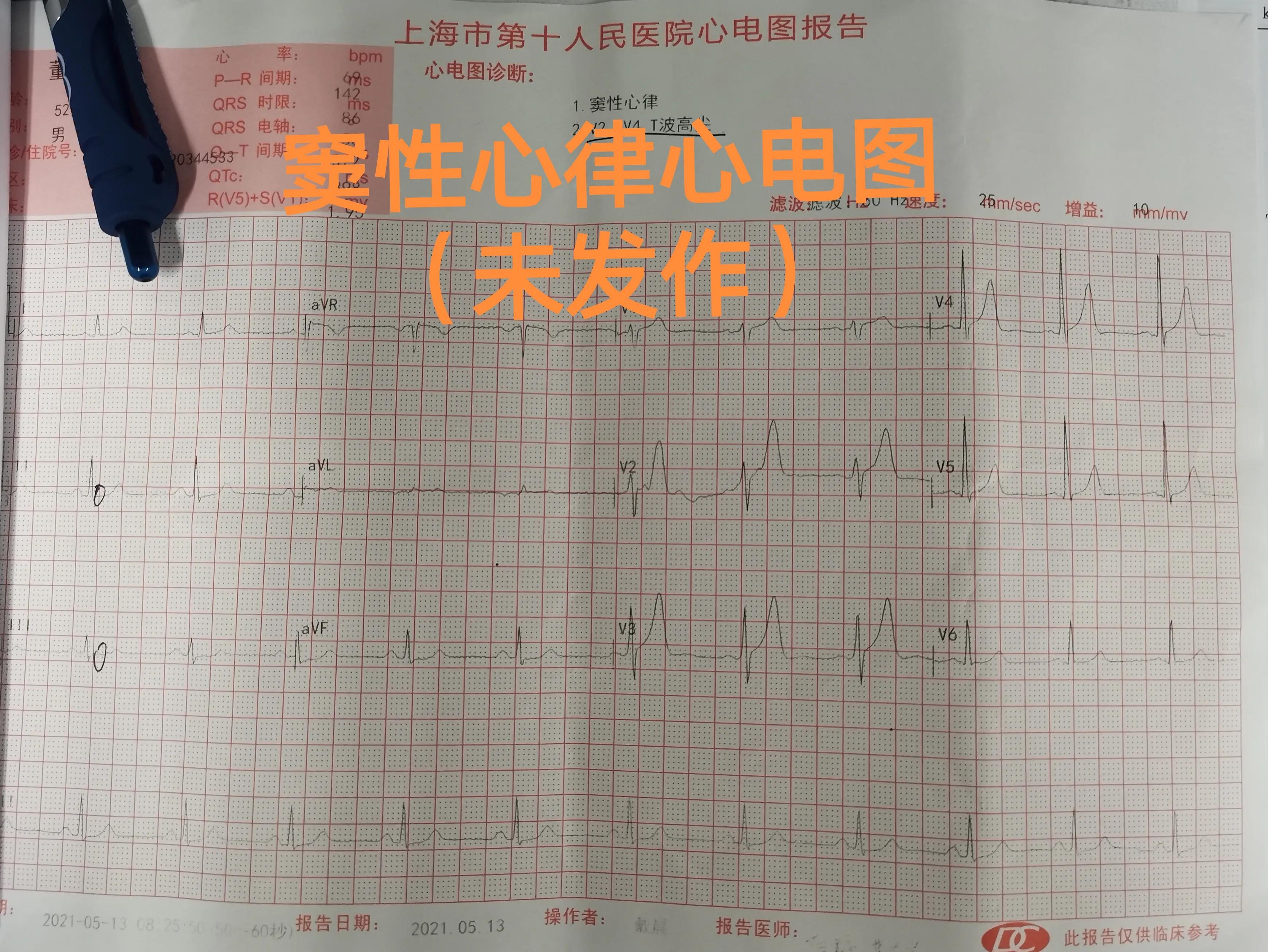 缁欒繙鍦ㄤ粬涔＄殑缃戝弸鎯呬功,缁欒繙鍦ㄤ粬涔＄殑缃戝弸瀵勪粈涔堢ぜ鐗╁ソ