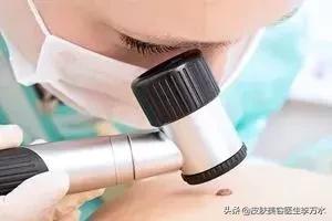 太阳光是uva还是uvb,太阳的紫外线是uvb吗