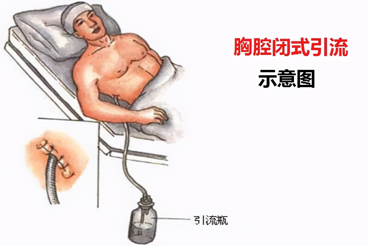 女孩咳嗽去医院输液后死亡,女孩咳嗽去医院抢救无效死亡