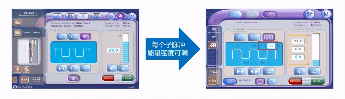 明星都在做的医美,光电光子嫩肤