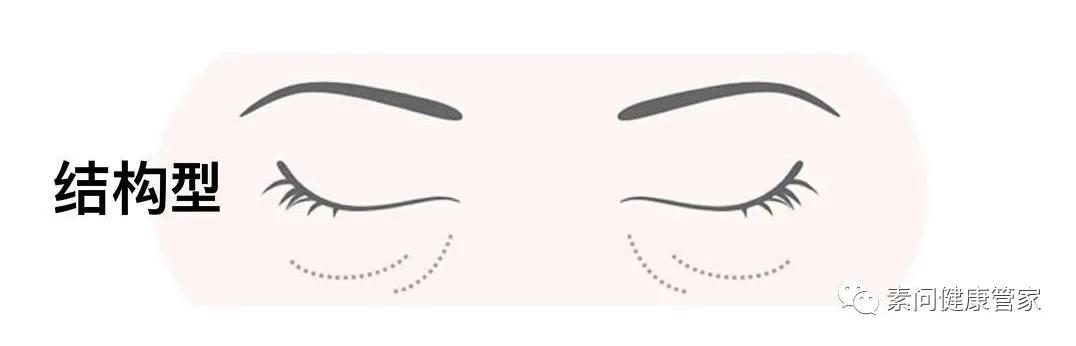 为什么眼袋黑眼圈太重,为什么熬夜会黑眼圈