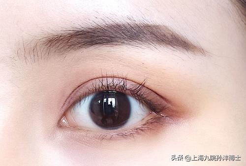 上海九院孙沣博士眼角修复,眼修复能找原来医生修复吗