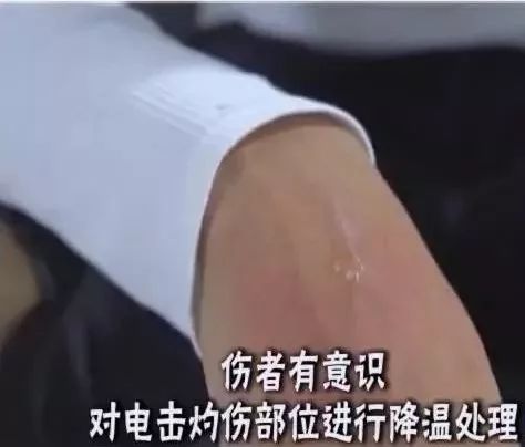 触电人神志清醒时救护方法步骤,触电后几分钟抢救最好