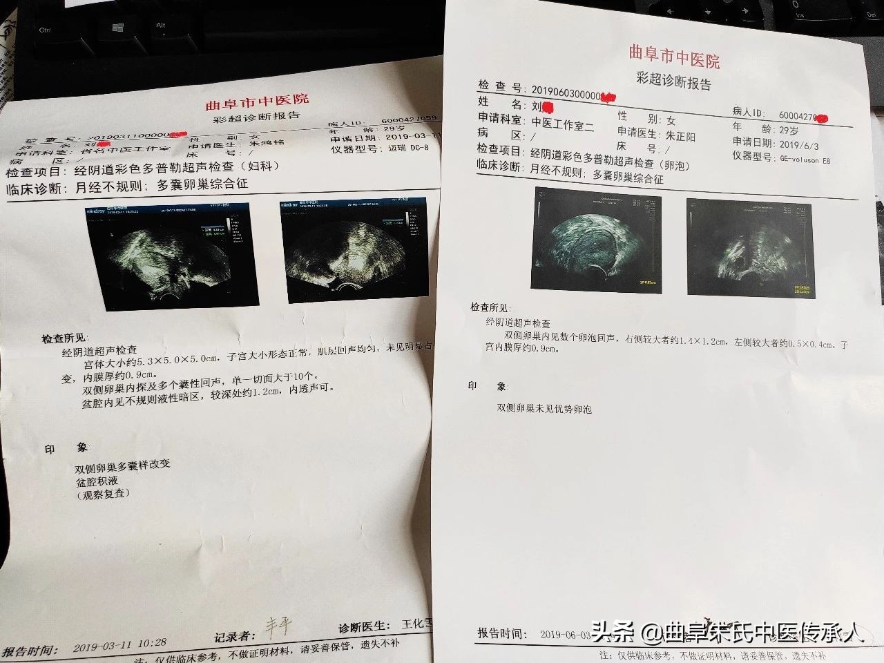 多囊快一年了不怀孕好难啊,得了多囊怀不了孕怎么办